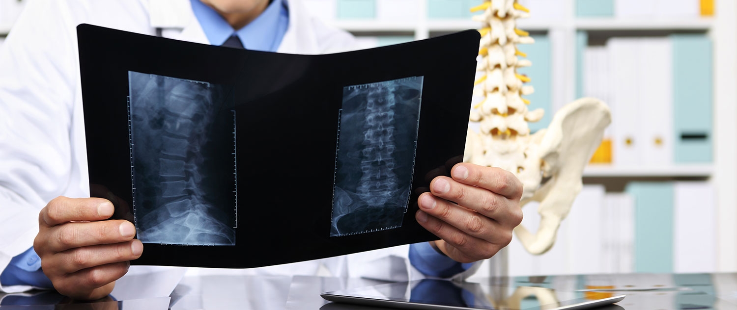 Common Issues That May Lead to Spinal Surgery