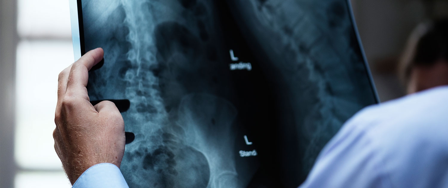 FAQs on Recovery from Minimally-Invasive Spine Surgery