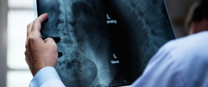 Dos and Don'ts After Spine Surgery